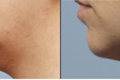 formaa_neck