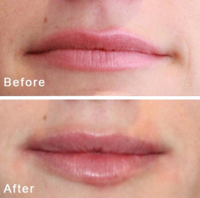 BA-Lips-11