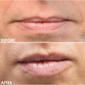 BA-Lips-4