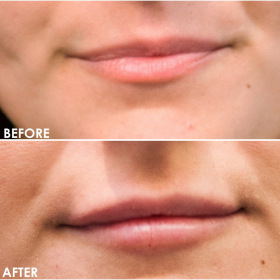 BA-Lips-7