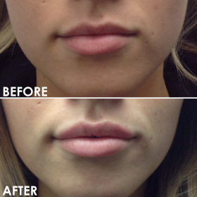 BA-Lips-8