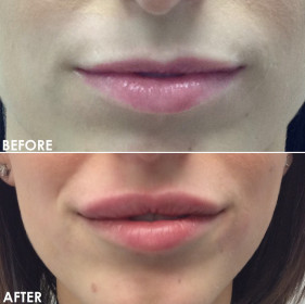 BA-Lips-9