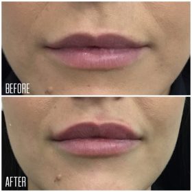 Lips-1-1200x1200