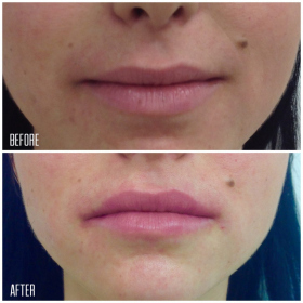 Lips-2-1200x1200