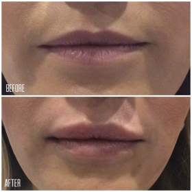 Lips-3-1200x1200