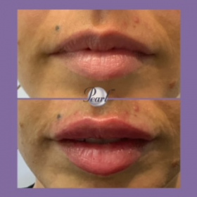 Lips_031721-1
