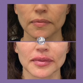 Lips_031721-3