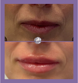 lips_01