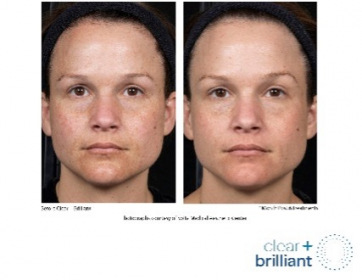 clear-and-blue_face