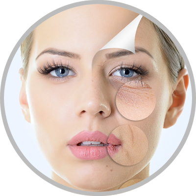 Electro-Microneedling