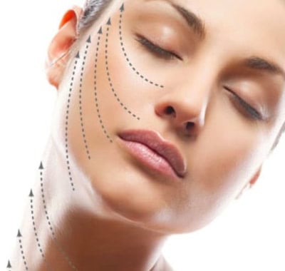 Non-surgical face lift treatment