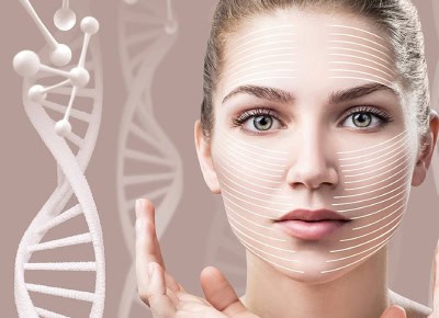 Thread lift facial contouring