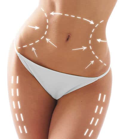 abdomen with contour marks